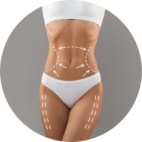 cirurgia-de-contorno-corporal